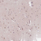 Immunohistochemical staining of human cerebral cortex shows moderate nuclear positivity in neurons.