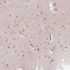 Immunohistochemical staining of human cerebral cortex shows moderate nuclear positivity in neurons.