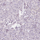 Immunohistochemical staining of human pancreas shows no positivity in exocrine glandular cells as expected.
