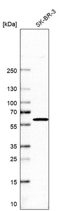 Western blot analysis in human cell line SK-BR-3.
