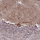 Anti-PTCHD4 Antibody