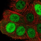 Immunofluorescent staining of human cell line MCF7 shows localization to nucleoplasm.