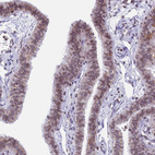 Immunohistochemical staining of human Fallopian tube shows moderate positivity in nuclear membrane in glandular cells.