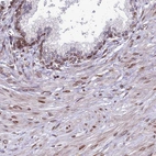 Immunohistochemical staining of human prostate shows moderate positivity in nuclear membrane in smooth muscle and glandular cells.
