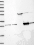 Lane 1: Marker [kDa] 250, 130, 95, 72, 55, 36, 28, 17, 10 | Lane 2: RT4 | Lane 3: U-251 MG | Lane 4: Human Plasma | Lane 5: Liver | Lane 6: Tonsil