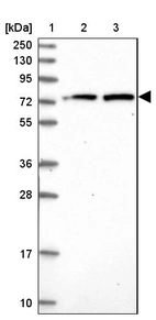 Lane 1: Marker [kDa] 250, 130, 95, 72, 55, 36, 28, 17, 10_br/_Lane 2: Human cell line RT-4_br/_Lane 3: Human cell line U-251MG sp