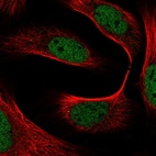 Immunofluorescent staining of human cell line U-2 OS shows localization to nucleoplasm.