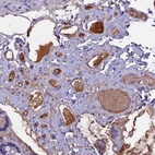 Anti-ANGPTL2 Antibody