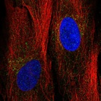 Immunofluorescent staining of human cell line BJ shows localization to the Golgi apparatus.