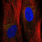 Anti-ANGPTL2 Antibody