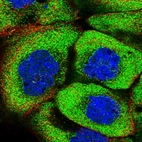 Immunofluorescent staining of human cell line A-431 shows localization to cytosol.