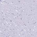 Immunohistochemical staining of human cerebral cortex shows no positivity in neurons as expected.
