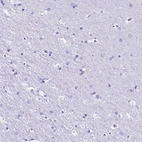Immunohistochemical staining of human cerebral cortex shows no positivity in neurons as expected.
