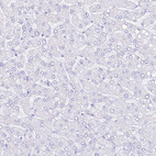 Immunohistochemical staining of human liver shows no positivity in hepatocytes as expected.