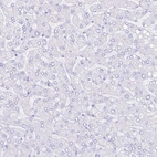 Immunohistochemical staining of human liver shows no positivity in hepatocytes as expected.