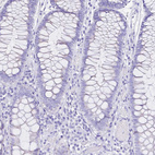 Immunohistochemical staining of human colon shows no positivity in glandular cells as expected.