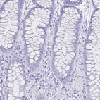 Immunohistochemical staining of human colon shows no positivity in glandular cells as expected.