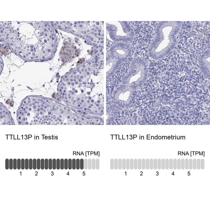 Anti-TTLL13P Antibody