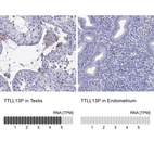 Anti-TTLL13P Antibody