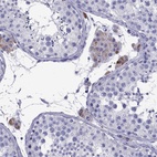 Anti-TTLL13P Antibody