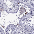 Immunohistochemical staining of human testis shows high expression.