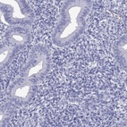 Anti-TTLL13P Antibody