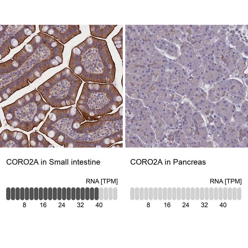 Anti-CORO2A Antibody