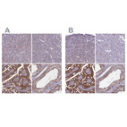 Immunohistochemical staining of human liver, pancreas, small intestine and testis using Anti-CORO2A antibody HPA041302 (A) shows similar protein distribution across tissues to independent antibody HPA041161 (B).
