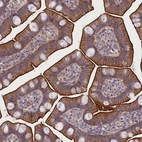 Immunohistochemical staining of human small intestine shows strong membranous and cytoplasmic positivity in glandular cells.