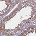 Immunohistochemical staining of human testis shows moderate membranous and cytoplasmic positivity in cells in seminiferous ducts.