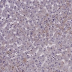 Immunohistochemical staining of human liver shows no positivity in hepatocytes as expected.