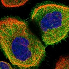 Immunofluorescent staining of human cell line A-431 shows localization to plasma membrane & cytosol.