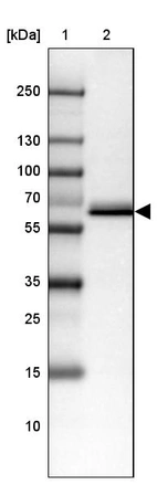 Lane 1: Marker [kDa] 250, 130, 100, 70, 55, 35, 25, 15, 10_br/_Lane 2: Human Liver tissue