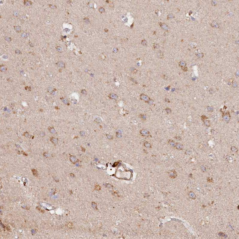 Anti-TANGO6 Antibody