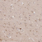 Anti-TANGO6 Antibody