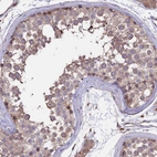 Immunohistochemical staining of human testis shows moderate cytoplasmic positivity in cells in seminiferous ducts.