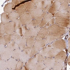 Immunohistochemical staining of human skeletal muscle shows strong cytoplasmic positivity in myocytes.