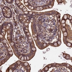 Immunohistochemical staining of human small intestine shows strong membranous and cytoplasmic positivity in glandular cells.