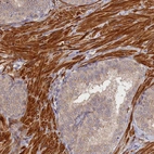 Immunohistochemical staining of human prostate shows strong cytoplasmic positivity in smooth muscle cells.