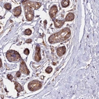 Immunohistochemical staining of human breast shows moderate to strong cytoplasmic and membranous positivity in glandular cells.