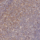 Immunohistochemical staining of human tonsil shows weak membranous and cytoplasmic positivity in germinal center cells.
