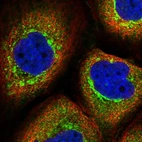 Immunofluorescent staining of human cell line A-431 shows localization to cytosol & the Golgi apparatus.