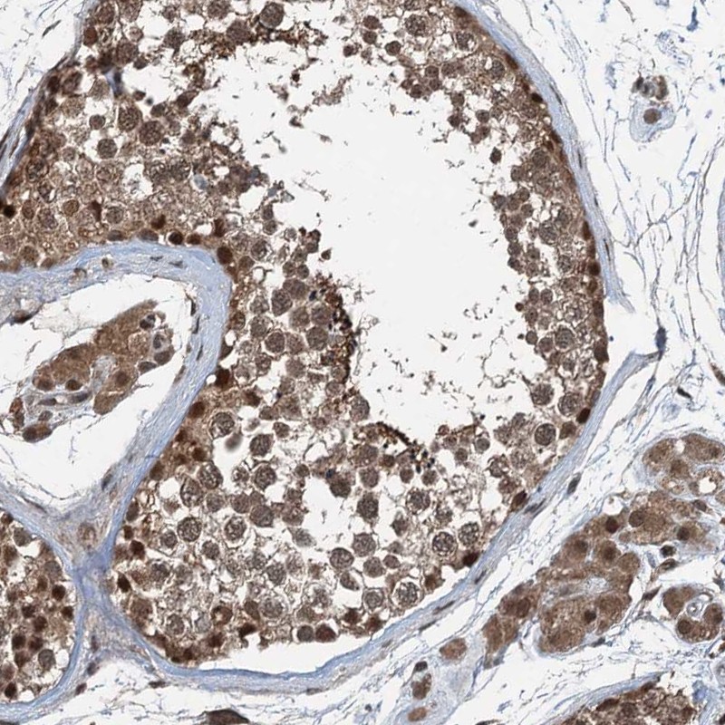 Anti-UBXN6 Antibody