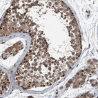 Anti-UBXN6 Antibody
