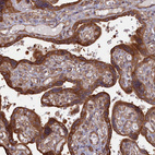Immunohistochemical staining of human placenta shows strong cytoplasmic positivity in trophoblastic cells.