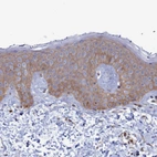 Immunohistochemical staining of human skin shows weak cytoplasmic positivity in squamous epithelial cells.