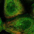 Immunofluorescent staining of human cell line A-431 shows localization to nucleoplasm, plasma membrane & cytosol.