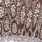 Anti-CFDP1 Antibody