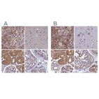 Anti-AMDHD2 Antibody