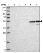 Lane 1: Marker [kDa] 250, 130, 95, 72, 55, 36, 28, 17, 10_br/_Lane 2: Human cell line RT-4_br/_Lane 3: Human cell line U-251MG sp_br/_Lane 4: Human plasma (IgG/HSA depleted)_br/_Lane 5: Human liver tissue_br/_Lane 6: Human tonsil tissue